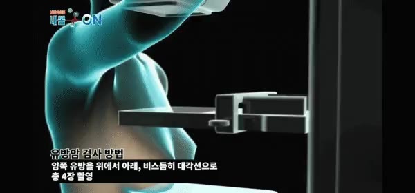 ㅋㅋ 유방암 검사 맘모그래피 고통 납작 압착 찌부 압축 으악