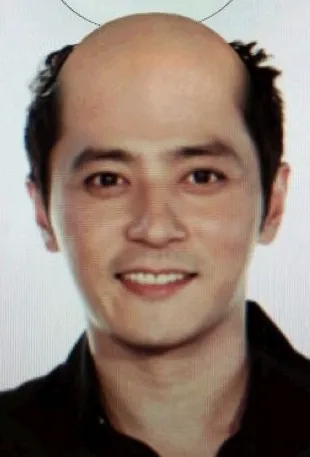탈모 장동건 대머리 머리빨의중요성 얼굴천재 충격 웃긴짤 합성