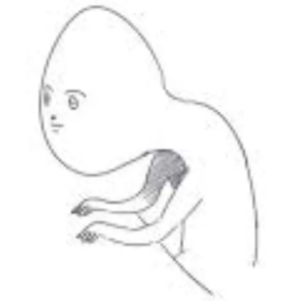 거북목 조심하자 스트레칭 해줘요 모두