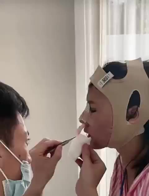 병원 입원 붕대 얼굴 성형 수술 회복 환자 근황