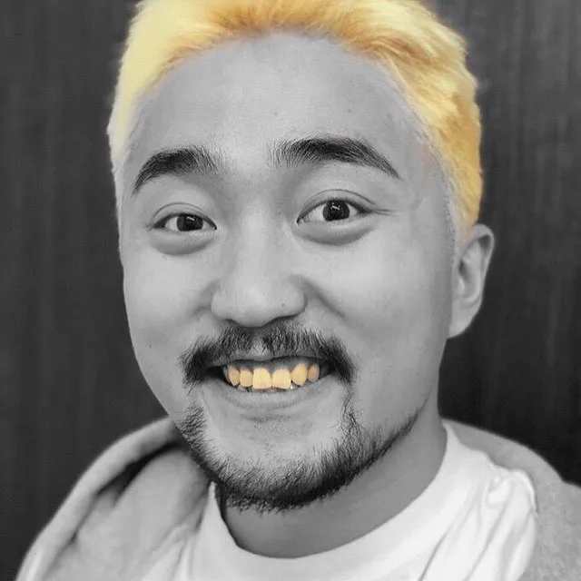 금니 누런이 황치 유병재 금니